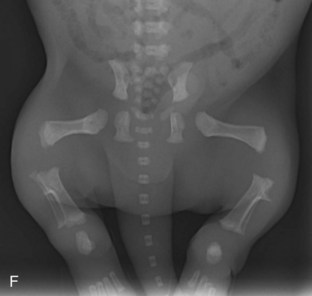 Radiografía de cachorro